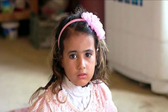 بیماری نادر پوستی دختر بچه عراقی + فیلم