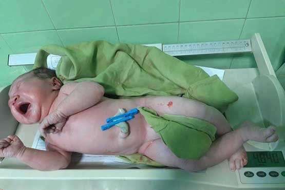 تولد  نوزاد ۵ کیلوگرمی در بیجار