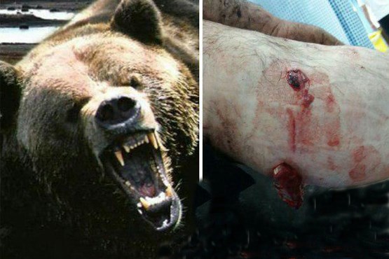 درگیری خونین خرس و پیرمرد قزوینی + عکس