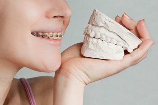 6 پارگی و ظن کامل نادرست دربارا آرتودنسه دندان تصور کن.